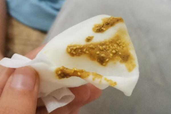 猫咪粪便是绿色的原因，一般是因为胆红素氧化变为胆绿素