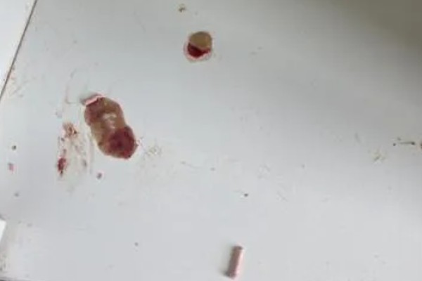 猫咪不埋屎是什么原因，可能是沙盆太脏所致