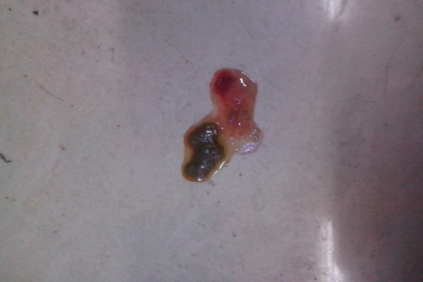 狗狗大便带血有粘液的原因，可能是得了狗球虫病