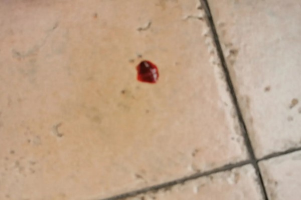 狗狗大便带血有粘液的原因，可能是得了狗球虫病