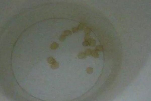 辣椒多少天发芽，由环境温度来决定