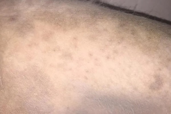 狗狗的皮肤变成黑色的原因，可能是色素沉淀所致