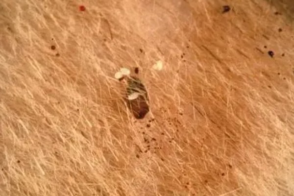 鸡身上的跳蚤用哪种药，可选择除虫菊酯、马拉硫磷等