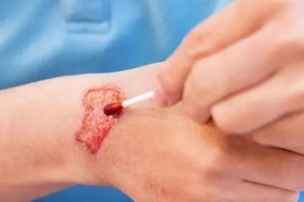 罗汉鱼会不会咬人，一般是不会咬人的