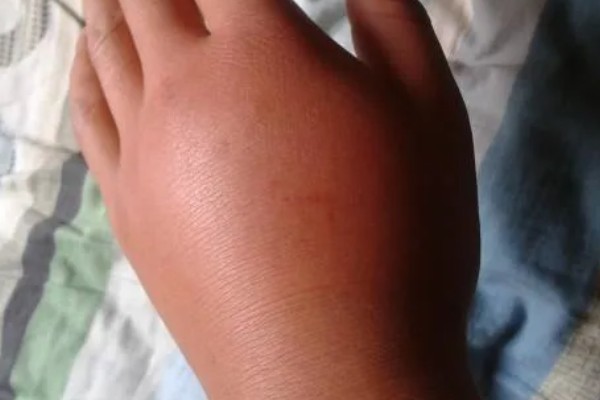 怎么找马蜂最快，可以利用食物来寻找