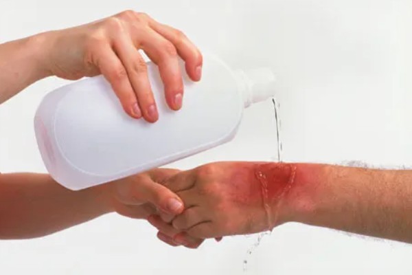 怎么找马蜂最快，可以利用食物来寻找