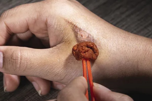 怎么找马蜂最快，可以利用食物来寻找