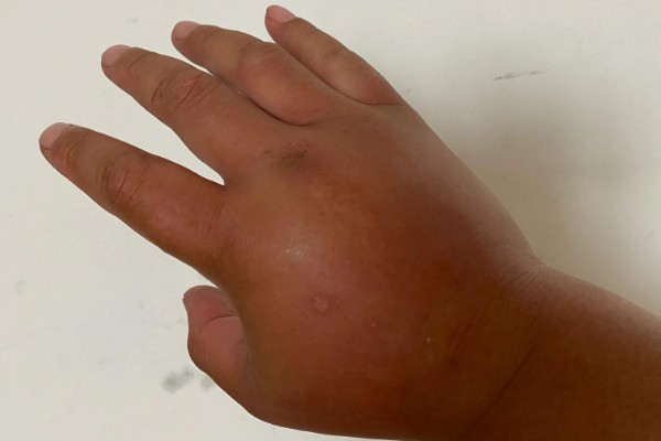 怎么找马蜂最快，可以利用食物来寻找