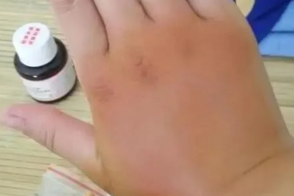 怎么找马蜂最快，可以利用食物来寻找