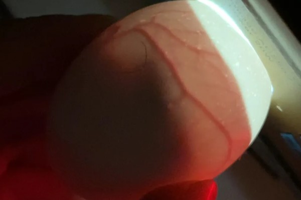 孵化鹅蛋照蛋几天能看见血丝，10天左右就可以